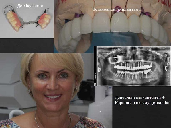 Знімок зубів та посмішка жінки