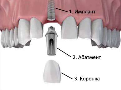 Зубная хирургия | Фото 2 - Клиника Лукашука