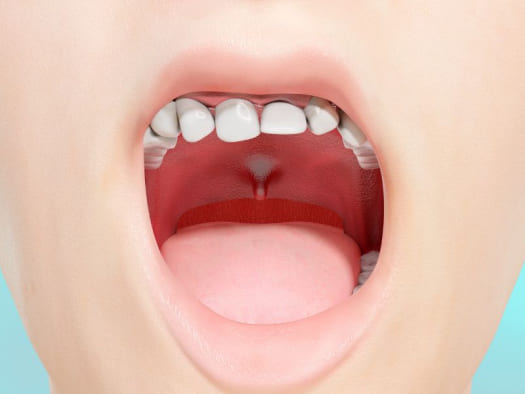 Як вирівняти кривизну зубів?