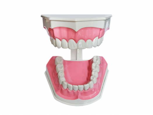 Пластика десны после имплантации зуба