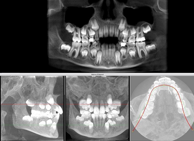 Компьютерная томография зубов (КТ, томограмма) в стоматологии в Киеве | Клиника Лукашука
