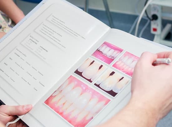 Протезирование зубов | Фото - Клиника Лукашука