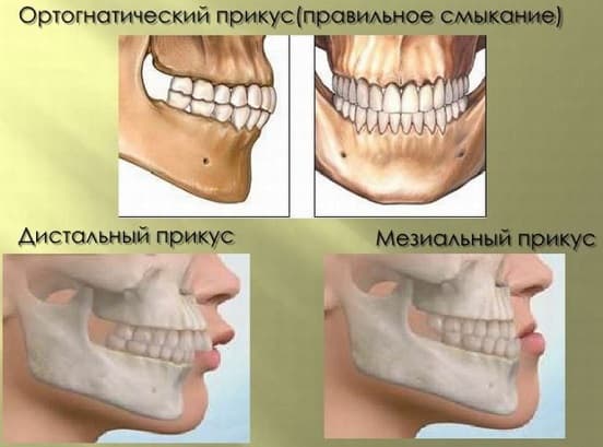 Что означает держать мазу