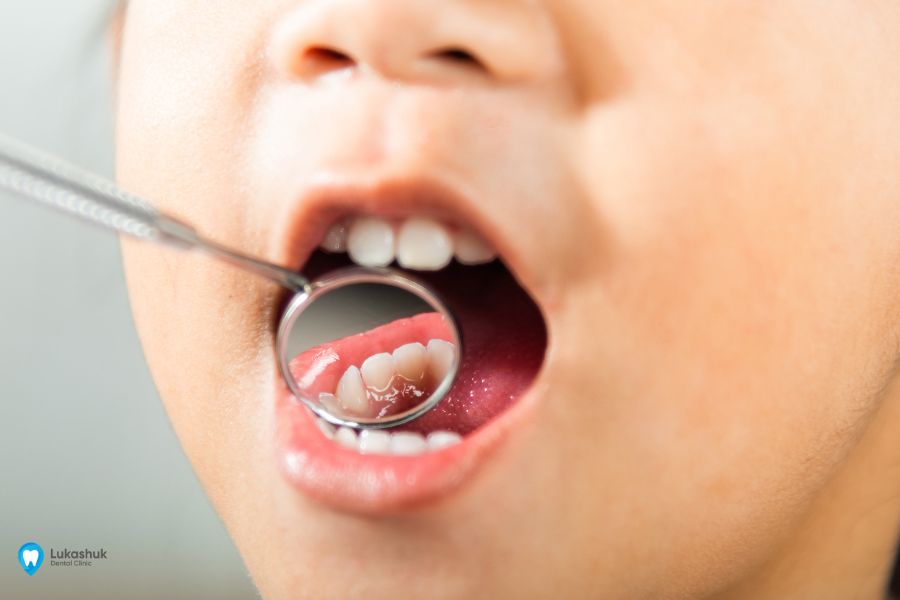 Нарушение прорезывания зубов у детей | Фото 1