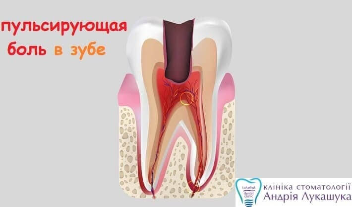 Боль в зубе