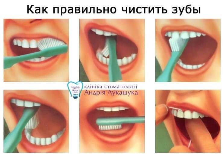 Как правильно чистить зубы