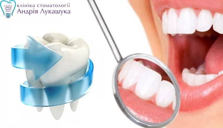Переваги фторування зубів