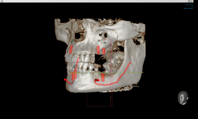 Компьютерная диагностика челюсти в клинике Лукашука