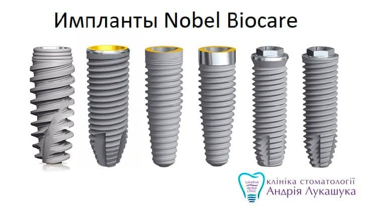 Импланты Nobel Biocare | Фото 2 - Клиника Лукашука