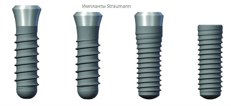Импланты Straumann (Штрауман) | Фото 2 - Клиника Лукашука