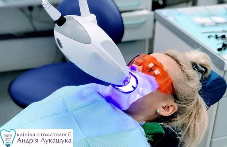 Отбеливание зубов холодным светом ZOOM | Фото 3 - Клиника Лукашука