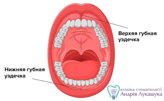 Пластика уздечки верхней и нижней губы | Фото 3 - Клиника Лукашука