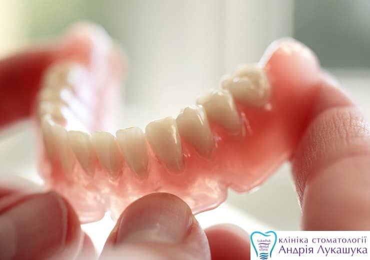 Съемные зубные протезы | Фото 3 - Клиника Лукашука