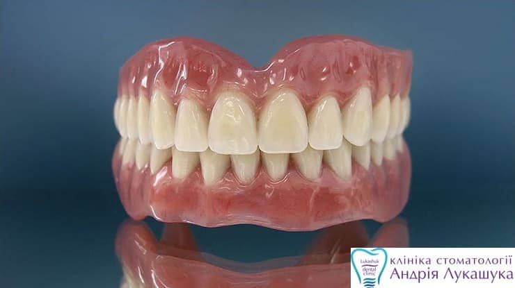 Съемные зубные протезы | Фото 4 - Клиника Лукашука