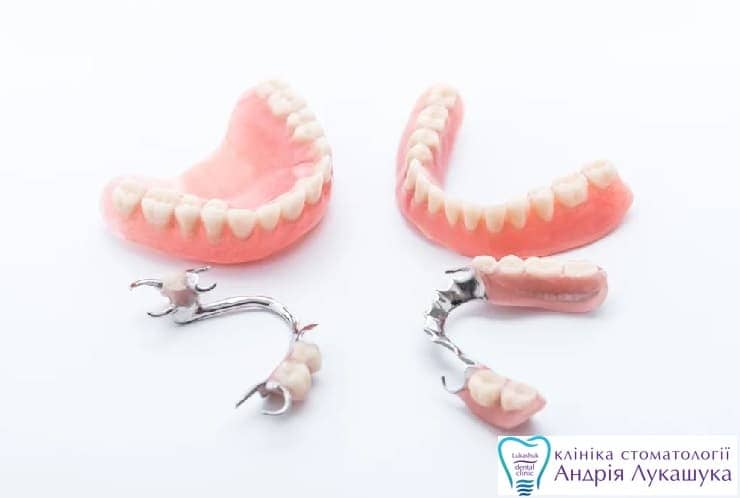 Съемные зубные протезы | Фото 2 - Клиника Лукашука