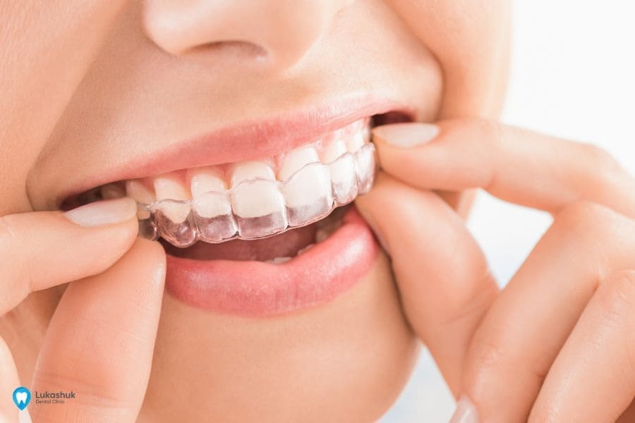 выравнивание зубов - клиника Лукашука