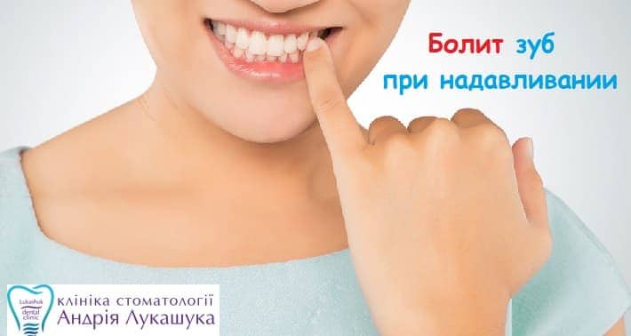 Болит зуб при надавливании (надкусывании) - Клиника Лукашука