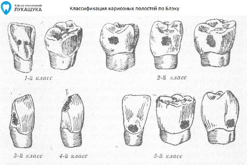 Блэк тейп проект