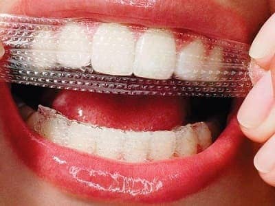 Как отбелить зубы | Полоски для отбеливания зубов