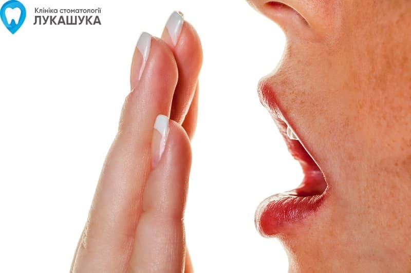 Запах изо рта (галитоз) | Фото 6 - Клиника Лукашука