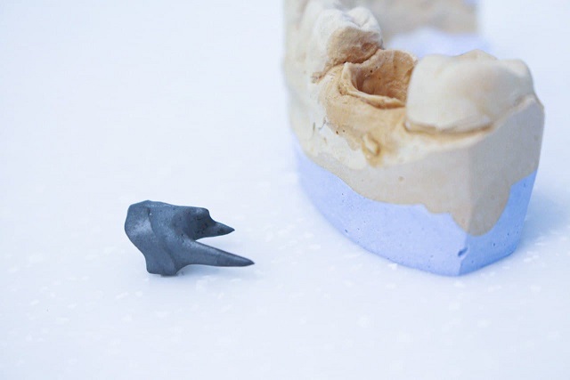 Культевая вкладка для поврежденного зуба в клинике лукашука | Фото 1