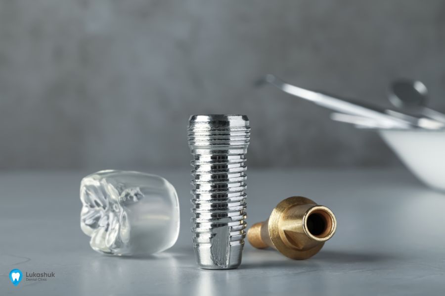 Инновационные покрытия для имплантатов | Фото 2 - Клиника Лукашука