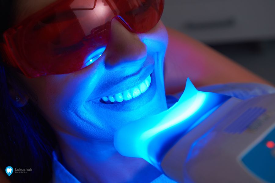 Стоматолог реставрирует зубы с помощью пломбирования