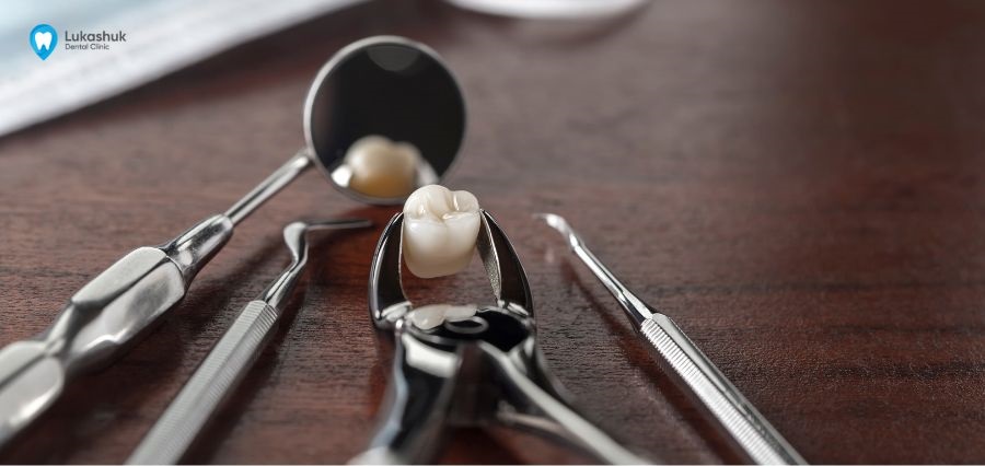 Удаление зуба в Киеве в Клинике Лукашука