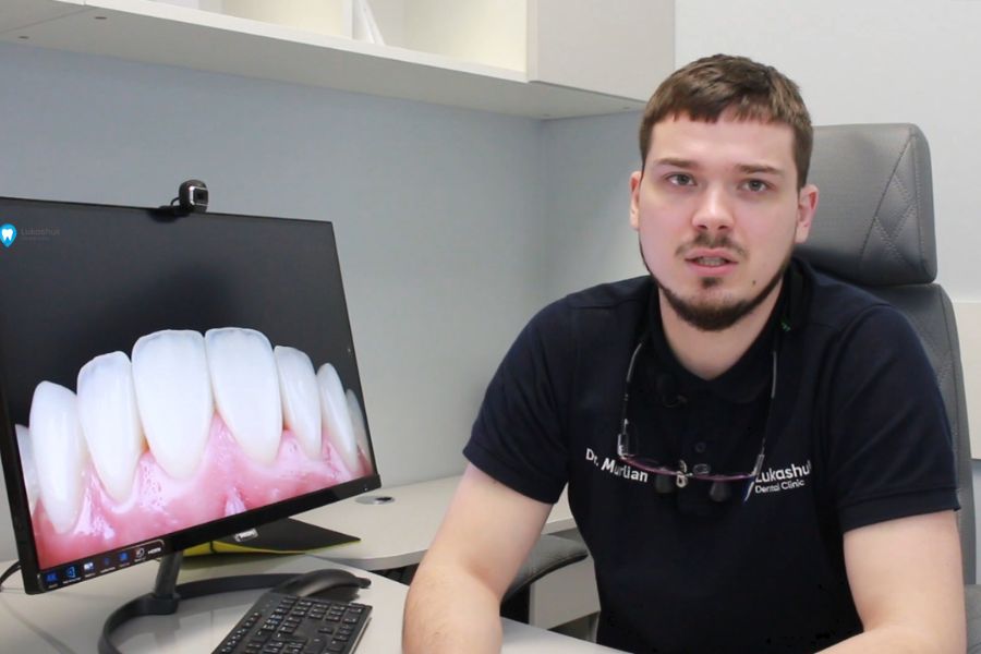 Доктор-ортопед дає рекомендації по догляду за зубами | Клініка Лукашука - Фото 2