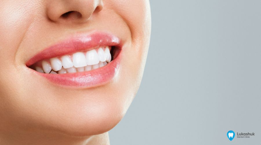 Зуби за 1 час | Клініка Лукашука