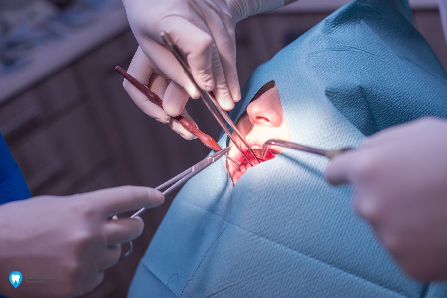 Зубна хірургія | Фото 1 - Клініка Лукашука